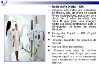  Radiografia Digital – DR:
- Imagens  adquiridas  por  aparelhos 
de raios-X que, ao invés de utilizar 
filmes  radiográficos,  possuem  uma 
placa  de  circuitos  sensíveis  aos 
raios  X  que  gera  uma  imagem 
digital e a envia diretamente para o 
computador  na  forma  de  sinais 
elétricos. 
 Radiografia Digital – DR (Digital
Radiology)
 Imagens adquiridas por aparelhos de
raios-X;
 Não usa filmes radiográficos;
 Possuem uma placa de circuitos
sensíveis aos raios X que gera uma
imagem digital e a envia diretamente
para o computador na forma de sinais
elétricos.
 