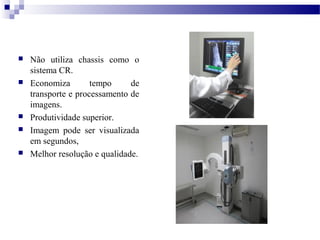  Não utiliza chassis como o
sistema CR.
 Economiza tempo de
transporte e processamento de
imagens.
 Produtividade superior.
 Imagem pode ser visualizada
em segundos,
 Melhor resolução e qualidade.
 