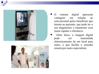  O sistema digital apresenta
vantagens em relação ao
convencional pelos benefícios que
trazem ao paciente, que pode ter o
seu diagnóstico e tratamento com
maior rapidez e eficiência.
 Além disso, a imagem digital
pode ser transmitida
eletronicamente de um local para
outro, o que facilita a consulta
remota por outro especialista.
 