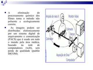  A eliminação do
processamento químico dos
filmes torna o método não
poluente e ecologicamente
correto.
 As imagens podem ser
distribuídas eletronicamente
por um sistema digital de
arquivamento e comunicação
(PACS) que é usado em todo
o mundo pela área médica,
baseado na rede de
computadores (web), sem
perda de qualidade (padrão
DICOM).
 