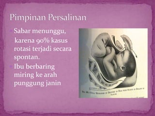  Sabar menunggu,
karena 90% kasus
rotasi terjadi secara
spontan.
 Ibu berbaring
miring ke arah
punggung janin
 