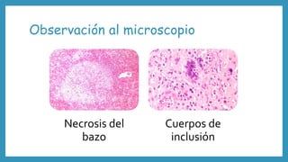 Observación al microscopio
Necrosis del
bazo
Cuerpos de
inclusión
 