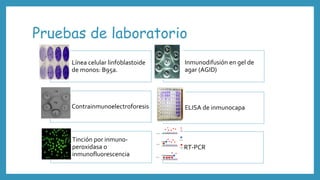 Pruebas de laboratorio
Línea celular linfoblastoide
de monos: B95a.
Inmunodifusión en gel de
agar (AGID)
Contrainmunoelectroforesis ELISA de inmunocapa
Tinción por inmuno-
peroxidasa o
inmunofluorescencia
RT-PCR
 