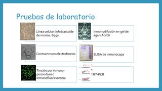 Pruebas de laboratorio
Línea celular linfoblastoide
de monos: B95a.
Inmunodifusión en gel de
agar (AGID)
Contrainmunoelectroforesis ELISA de inmunocapa
Tinción por inmuno-
peroxidasa o
inmunofluorescencia
RT-PCR
 