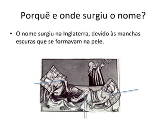 Porquê e onde surgiu o nome? O nome surgiu na Inglaterra, devido às manchas escuras que se formavam na pele. 