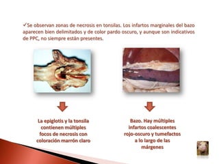 Signos nerviosos (temblores, mancha ondulante, andar en “punta de ballet”, posición “sentado”, caída del tren posterior, “pedaleo”)