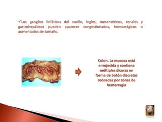 Conjuntivitis catarral con abundantes secreciones (legañas)