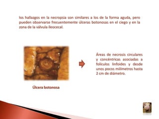 Constipación seguida de diarrea de color amarillo a rojizo (hemorrágica)Cianosis y eritema del hocico