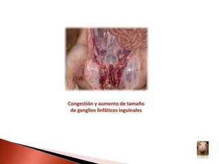 Cianosis en la zona medial de las extremidades y cara interna de los muslosEritema y hemorragias petequiales en abdomen