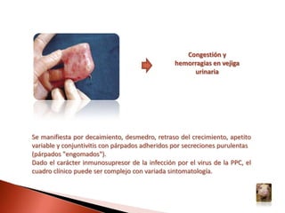 Rigidez de la colaDiarreas 