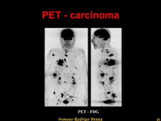 PET - carcinoma Professor  Rodrigo Penna  www.fisicanovestibular.com.br   
