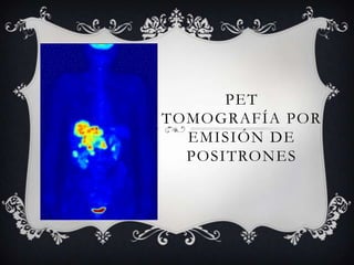 PET
TOMOGRAFÍA POR
  EMISIÓN DE
  POSITRONES
 