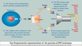 Positron Emission Tomography (PET).pdf