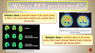 Parkinson's disease: A progressive disease of the nervous system
in which a fine tremor, muscle weakness, and a peculiar type of
gait are seen.
Fig: PET scans of a (a) normal brain and (b) brain with
Parkinson disease.
Huntington's disease: A hereditary disease of the nervous
system which causes increasing dementia, bizarre involuntary
movements, and abnormal posture.
https://images.app.goo.gl/DTUTa2TFDQEQUgvB8
 