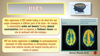(Source:Waarde,2012)
Other applications of PET include looking at the blood flow and
oxygen consumption in different parts of the brain—for example,
in understanding strokes and dementia.Tracking chemical
neurotransmitters (such as dopamine, in Parkinson's disease) can
also be performed with this technique.
PET has further applications in cardiology (in pretransplantation
assessment of viable myocardium), in distinguishing recurrent
tumours from radiation necrosis and surgical scarring, and in a
variety of cancers.
https://images.app.goo.gl/3azZ2Rx9wRppmow27
 