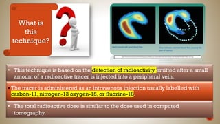 • This technique is based on the detection of radioactivity emitted after a small
amount of a radioactive tracer is injected into a peripheral vein.
What is
this
technique?
▪ The tracer is administered as an intravenous injection usually labelled with
carbon-11, nitrogen-13 oxygen-15, or fluorine-18.
• The total radioactive dose is similar to the dose used in computed
tomography.
https://www.ncbi.nlm.nih.gov/core/lw/2.0/html/tileshop_pmc/tileshop_pmc_inline.html?title=Click%20on%20image%20to%20zoom&p=PMC3&id=1126321_1449_f1.jpg
 