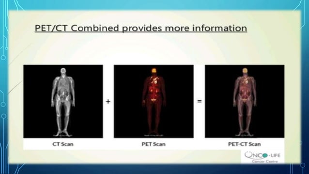 PET-CT | PPTX | Cancer | Diseases and Conditions