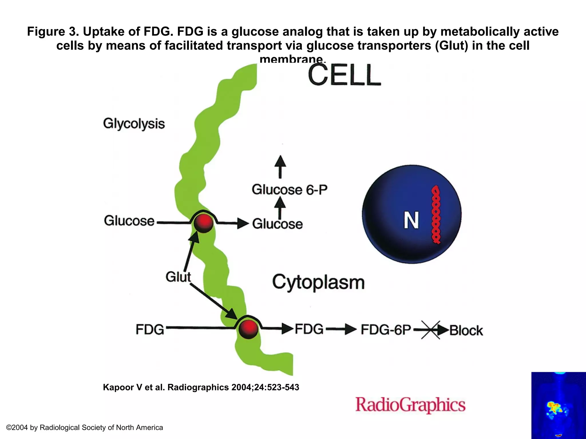 PET-CT Scan(Principles and Basics) | PDF