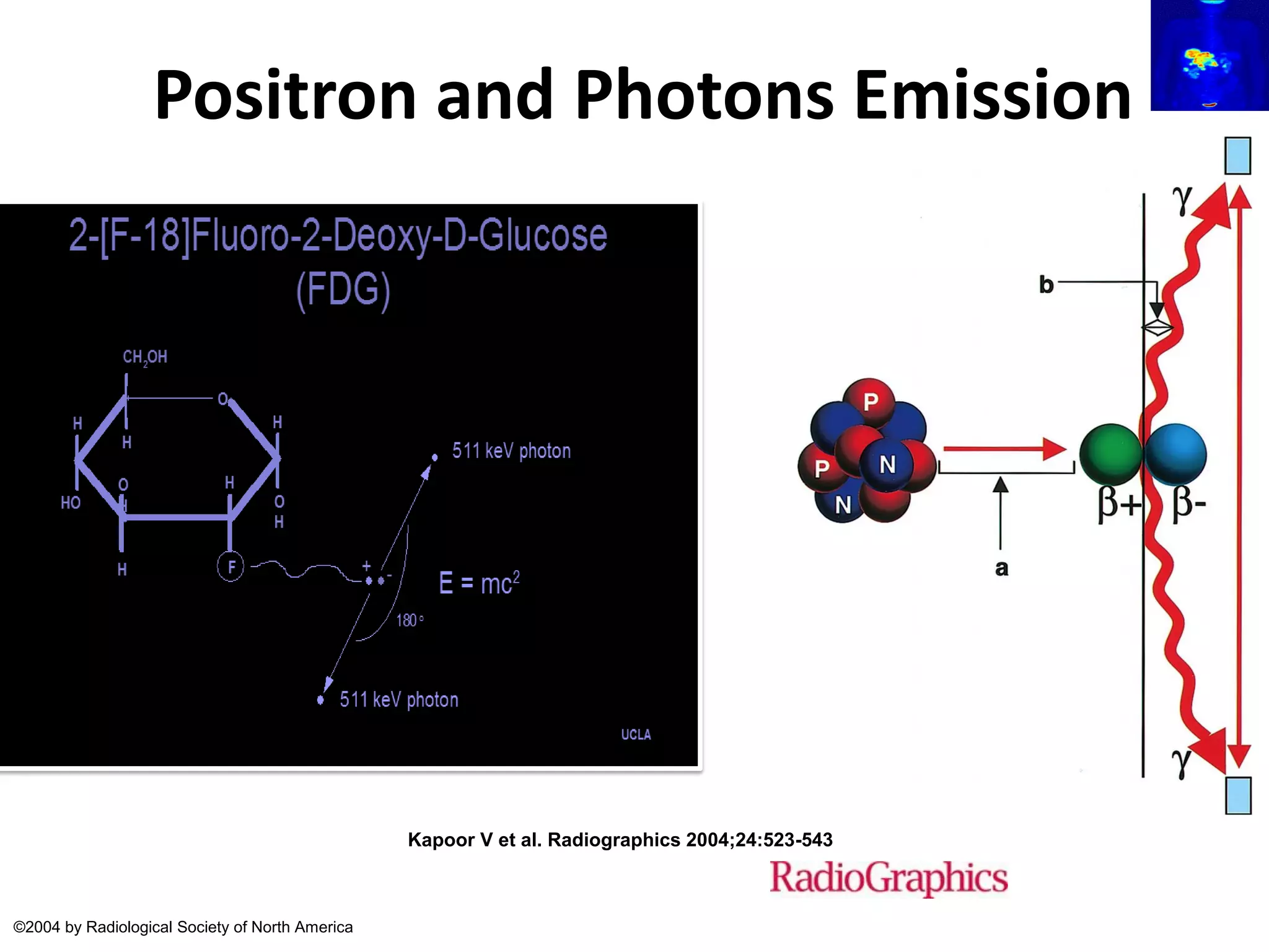 PET-CT Scan(Principles and Basics) | PDF