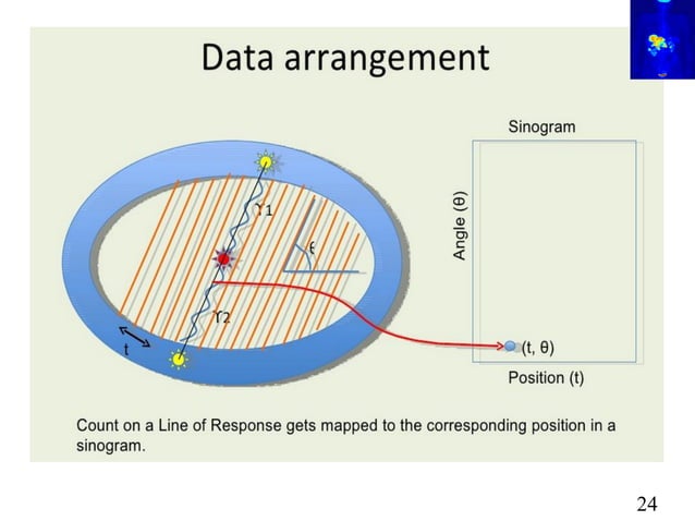PET-CT Scan(Principles and Basics) | PDF | Lung and Respiratory Health ...