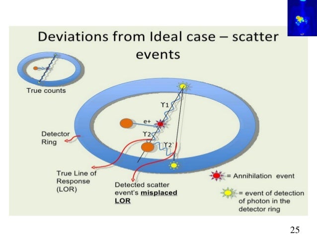 PET-CT Scan(Principles and Basics)