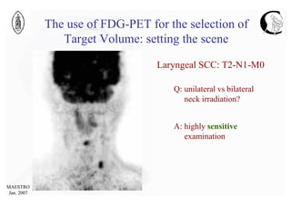 Pet And Radiotherapy For Head And Neck | PDF