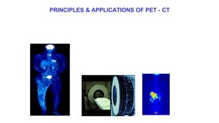 PRINCIPLES & APPLICATIONS OF PET - CT
 