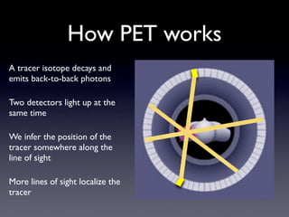 PET CT
