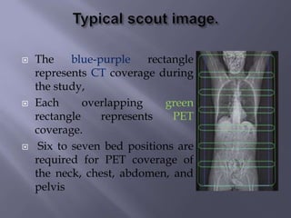  The blue-purple rectangle
represents CT coverage during
the study,
 Each overlapping green
rectangle represents PET
coverage.
 Six to seven bed positions are
required for PET coverage of
the neck, chest, abdomen, and
pelvis
 