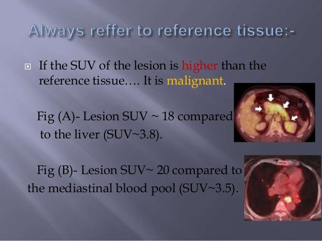 Pet ct technique