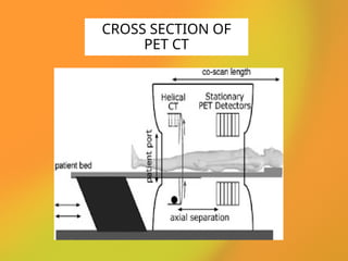 CROSS SECTION OF
PET CT
 