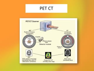 PET CT
 