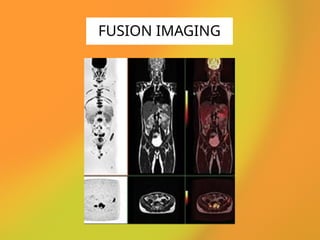 FUSION IMAGING
 