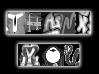 Pet ct and its benefit vs risk