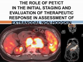 Pet ct assessment of therapeutic response in extra-nodal non Hodgkin ...