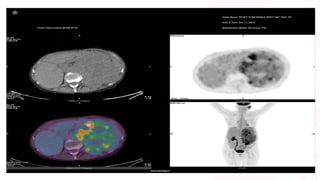 PET CT beginners Guide covers some of the underrepresented topics in ...