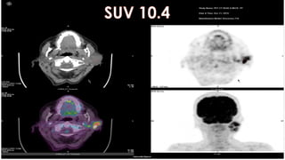 PET CT beginners Guide covers some of the underrepresented topics in ...