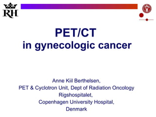 PET/CT  in  gynecologic  cancer Anne Kiil Berthelsen, PET & Cyclotron Unit, Dept of Radiation Oncology Rigshospitalet,  Copenhagen University Hospital, Denmark 