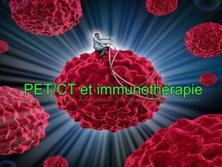 PET/CT et immunothérapie
 