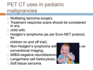 Pet ct in pediatric malignancies | PPTX