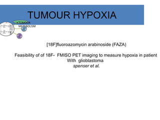 TUMOUR HYPOXIA
•TUMOUR
METABOLISM
[18F]fluoroazomycin arabinoside (FAZA)
Feasibility of of 18F- FMISO PET imaging to measure hypoxia in patient
With glioblastoma
spenser et al.
 