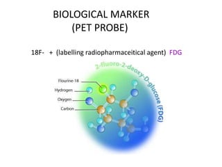 BIOLOGICAL MARKER
(PET PROBE)
18F- + (labelling radiopharmaceitical agent) FDG
 