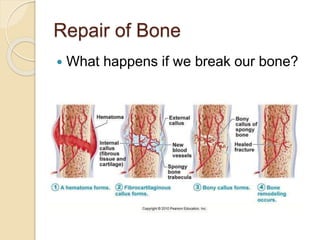 Repair of Bone
 What happens if we break our bone?
 