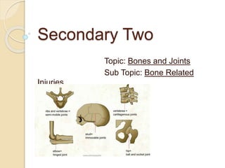 Secondary Two
Topic: Bones and Joints
Sub Topic: Bone Related
Injuries
 