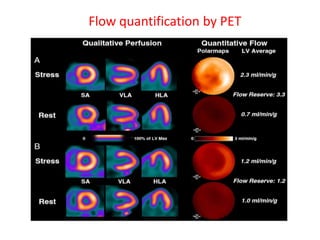 Flow quantification by PET
 