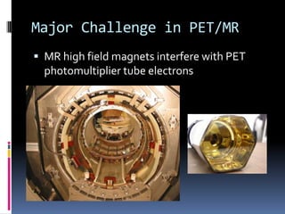 PET MR Biomedical Engineers Perspective | PPTX
