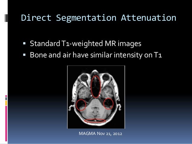 breast ct mr template set pet mr biomedical engineers perspective breast ct mr template set pet mr biomedical engineers perspective