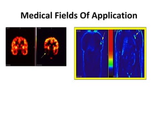 Medical Fields Of Application
 