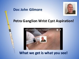 Petra Ganglion Wrist Cyst Aspiration!
What we get is what you see!
Doc John Gilmore
 