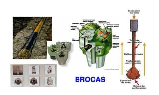 BROCAS
 